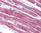 NDUFAF2 / NDUFA12L Antibody (C-Terminus)
